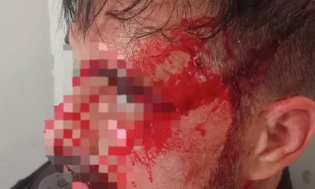 Policías y guardias civiles de la Región piden pistolas táser para todos ante el repunte de agresiones que sufren