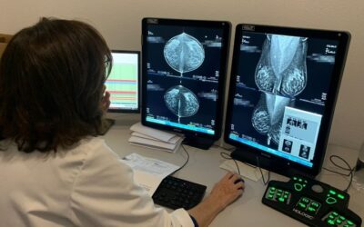 Salud incorporará la doble lectura de pruebas de cribado de cáncer de mama mediante inteligencia artificial