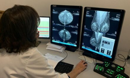 Salud incorporará la doble lectura de pruebas de cribado de cáncer de mama mediante inteligencia artificial