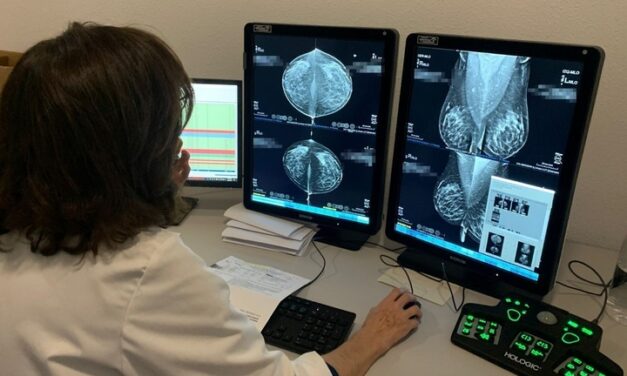 Salud incorporará la doble lectura de pruebas de cribado de cáncer de mama mediante inteligencia artificial